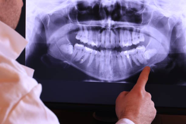 Best Root Canal Emergency Dentist  in Grovetown, GA