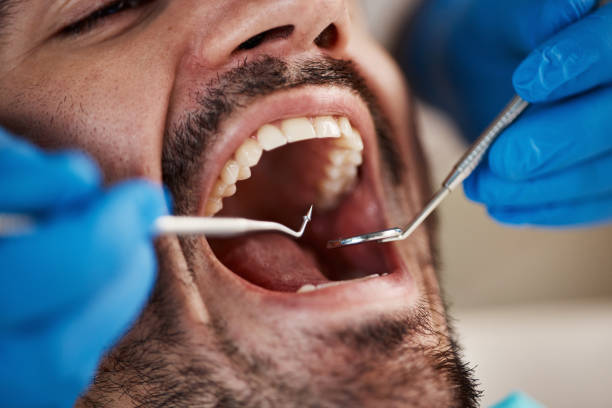 Best Broken Tooth Emergency  in Grovetown, GA